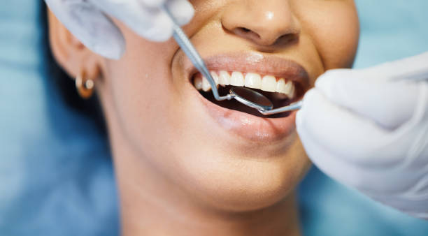 Best Emergency Treatment for Dental Infections or Abscesses in Bay Harbor Islands, FL